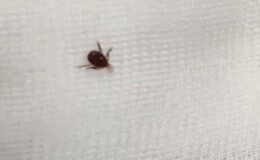 Diyarbakır’da Kene Vakası Görüldü